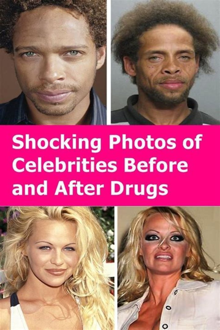 16 Shocking Celebrity Before & After Transformations Page 11 of 16