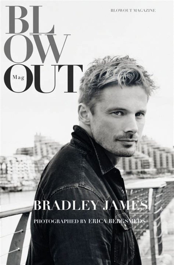 Did Bradley James Fix his Teeth? Why that's bad HubPages