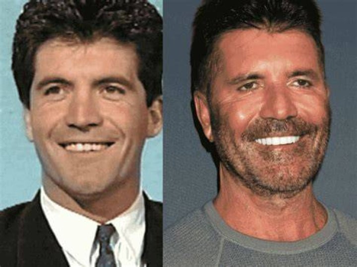 Exploring Whether Simon Cowell's Son Has A Disability