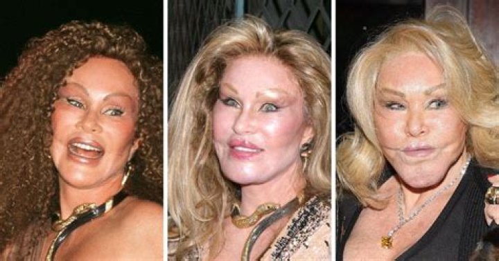 How Jocelyn Wildenstein Destroyed Her Face With Plastic Surgery