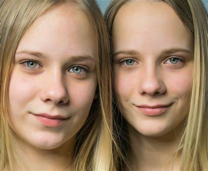 Identical twins no longer identical early in development