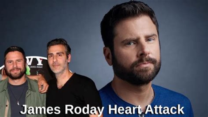 James Roday Heart Attack Did The Heart Surgery Lead To His Chest Scar