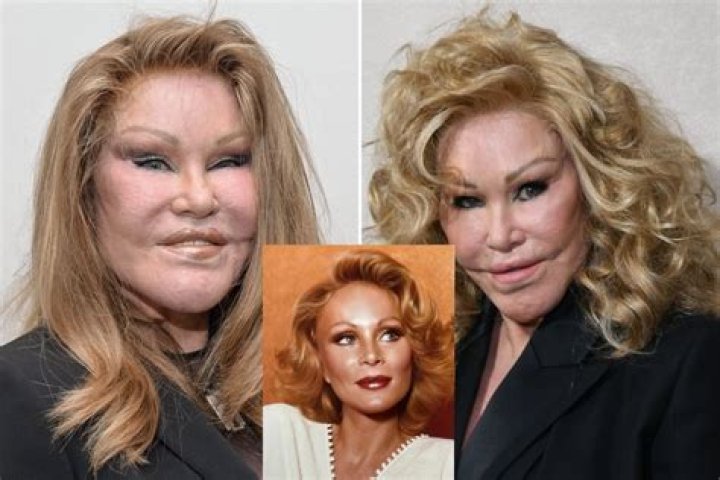 jocelyn wildenstein before surgery Would Look Like &rarr; jocelyn