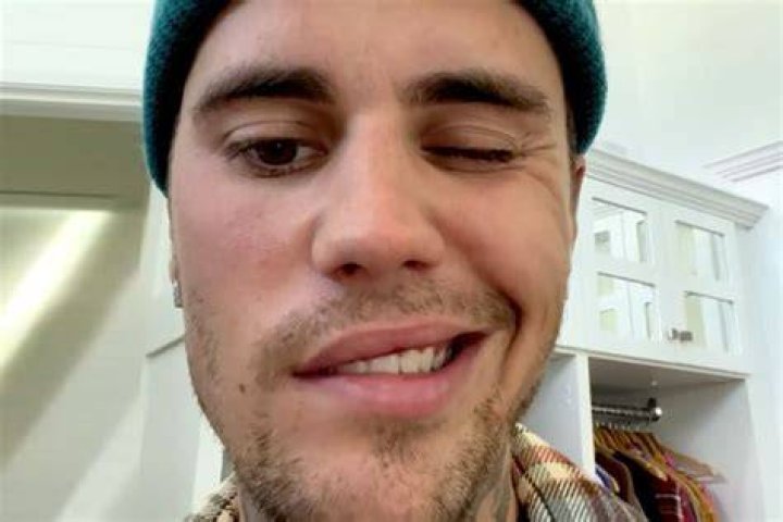 Justin Bieber Reveals He Has Been Diagnosed Ramsay Hunt Syndrome