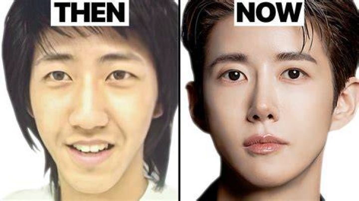 Korean Actors Before And After Plastic Surgery Korean Actors/actresses