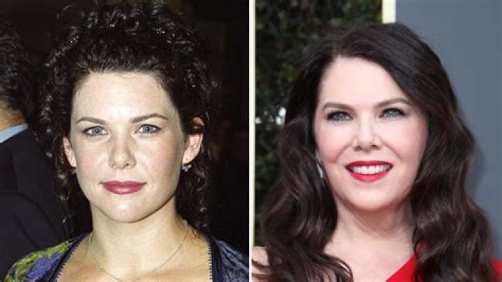 Lauren Graham Plastic Surgery 'Gilmore Girls' Star Transformed