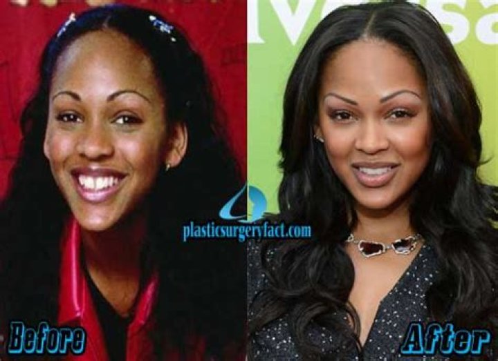 Meagan Good Plastic Surgery Before After Pictures