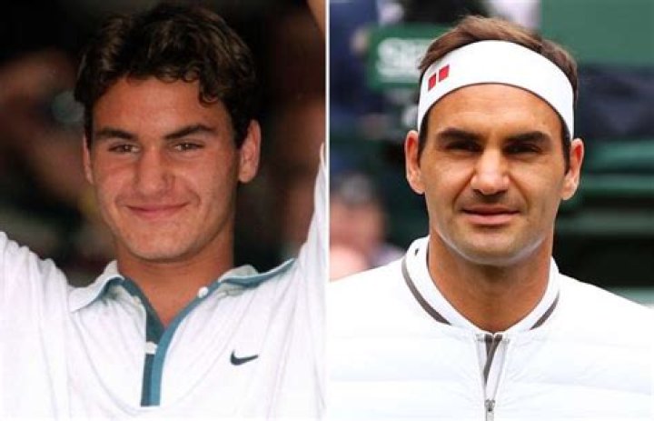 Roger Federer Nose Job Before And After Photos