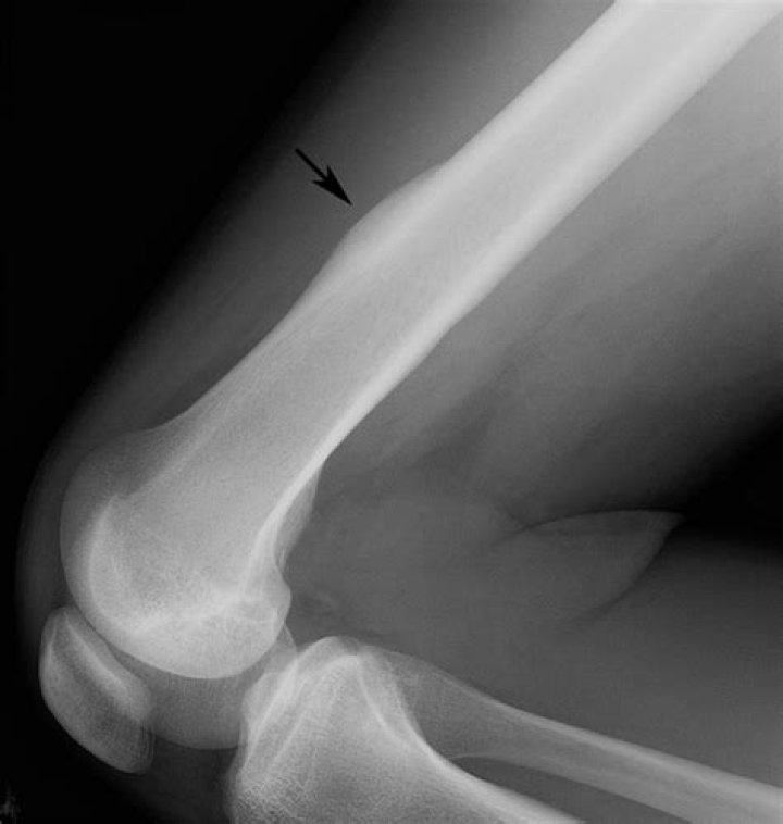 Unseen Perspectives On Tibia Case Daniel Photos